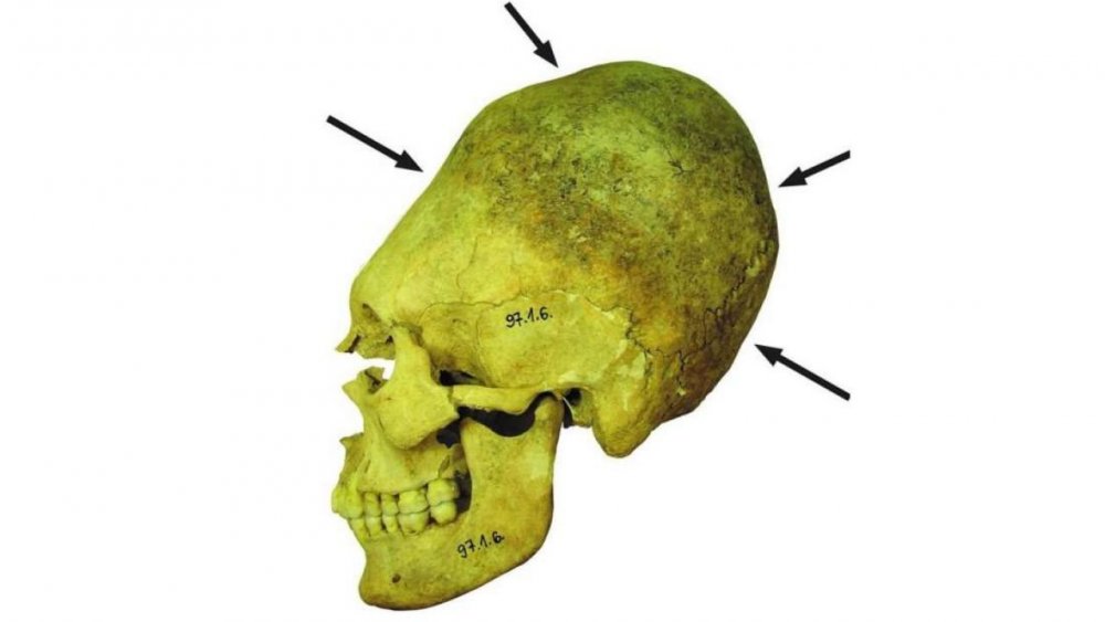 ritrovate-ungheria-dozzine-crani-forma-allungata-risalenti-all-impero-romano-v3-443648-1280x720.jpg